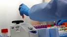 Число заболевших на Южном Урале перевалило за три сотни 
